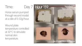 Foam Dressing Comparison - ALLEVYN Non Adhesive vs TegadermTM Non Adhesive
