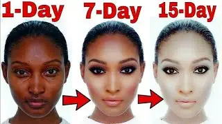 5 Step to clear skin forever, साफ त्वचा पाने के 5 Step,Clear skin, Wrinkles Free Skin,Skin whitening