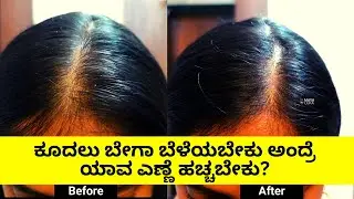 🤔 ಕೂದಲು ಬೇಗಾ ಬೆಳೆಯಬೇಕು ಅಂದ್ರೆ ಯಾವ ಎಣ್ಣೆ ಹಚ್ಚಬೇಕು? Dabur Neelibhringa 21 Hair Growth Oil Vs Induleka
