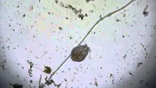 Tardigrade - Cryptobiose