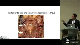 Anatomical Study of the Posterior Ascending Artery
