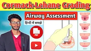 Cormack-Lehane Grading in Hindi | Airway Management Simplified | Check of Glottis Opening