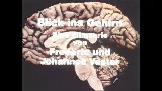 Blick ins Gehirn - Klett Film... (LaserDisc)