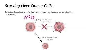 Targeted Therapy for Liver Cancer by Chris Drouillard (CURES 2020)