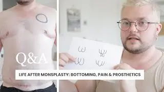 3 MONTHS POST MONSPLASTY Q+A | Bottoming during s*x, Pain, Mobility, Using prosthetics & more! FTM