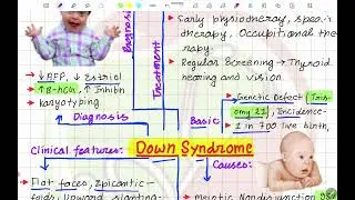 Down Syndrome Mind Map For Every Medical Student #mbbs #fmge #neetpg #inicet