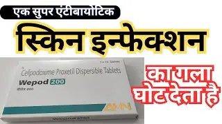 एक सुपर एंटीबायोटिक जो स्किन इन्फेक्शन का गला घोट देता है | Wepod Tablets | Antibiotic Review