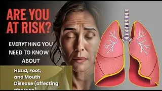 Hand, Foot, and Mouth Disease (affecting pharynx) Explained Causes, Symptoms and Treatment, All
