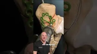 Best Fix For Most Painful Type of Bone Fracture⁉️