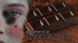 Stop Eating Chocolate! Does Chocolate Cause Pimples ?