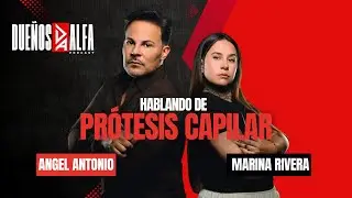 &iquest;Cansado de la calvicie? Hablemos de Pr&oacute;tesis Capilar
