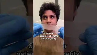 Did you know mouth taping can help prevent a double chin and snatch your jawline? #medspa #mouthtape