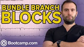 Conduction Blocks - Bundle Branch Blocks | HIGH-YIELD CARDIOLOGY | USMLE STEP 1