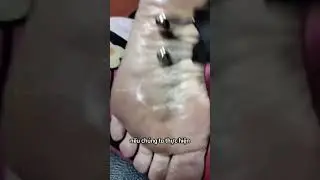 Cạo gi&oacute; l&agrave; g&igrave; giải ph&aacute;p v&agrave;ng cho sức khỏe tự nhi&ecirc;n