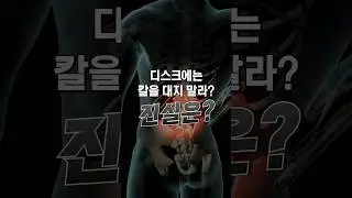 허리 디스크 수술의 진실? 수술을 꼭 받아야 하는 경우 두 가지!✌️