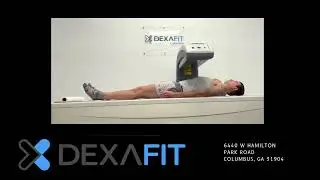 Here&rsquo;s what a real DexaFit DEXA Scan looks like!