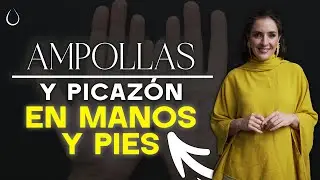 🔴 No es HONGOS es DISHIDROSIS @drapilarochoa - Dermatologa