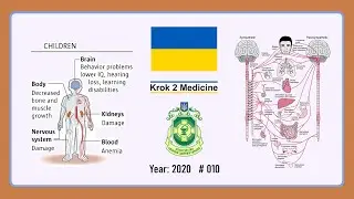 [ Krok 2 Medicine ] Year: 2020 - 010 (Ministry of Public Health of Ukraine)