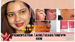 (Pigmentation/scars/uneven skin/ skin brightening) इतने सारी प्रॉब्लम 1 ही सॉल्यूशन #muskanmakeover
