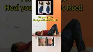 simple exercise to reduce mummy tummy #viral #trending #short#shorts #bellyfat #pregnancy#shortvideo
