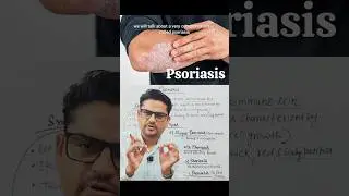 Psoriasis 🔥 | Autoimmune Disease