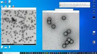 EM viral particles counting