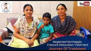 Neglected Monteggia Fracture Dislocation in a Child &ndash; Surgery & Recovery | Parent Testimonial
