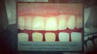 Affordable General Family Dentistry