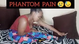 Phantom sensation and Phantom Limb Pain 😓                                     #phantompain #amputee