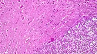 Microscopic Prepartion Spinal cord cell TS 400x magnification coloured by pink