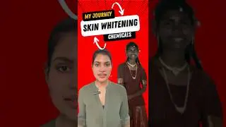 My Journey Skin whitening Chemicals 100% Results | Maira Cosmetics
