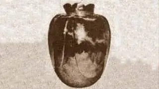 The Cursed Basano Vase