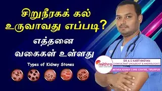 KIDNEY STONE FORMATION AND STONE TYPES | சிறுநீரகக் கல் உருவாவது எப்படி? எத்தனை வகைகள் உள்ளது