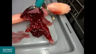 Simulated Salpingostomy using Simsei Models with VeriSim Tissue