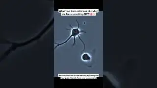 This is how your brain cells act when you learn something new #shorts #neuroscience #neuroplasticity