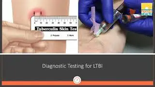 The Role of Interferon Gamma Release Assay (IGRA) Testing in the TB Testing Program