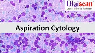 Aspiration Cytology Made Easy with Digiscan!