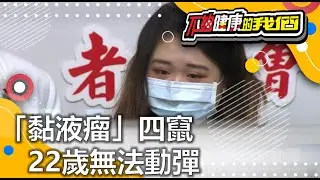 「黏液瘤」四竄 22歲無法動彈 | 罕見疾病 | 不夠健康的我們 |  @GTV健康NO.1
