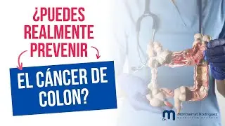 &iquest;Puedes Detener el C&aacute;ncer de Colon Antes de que Sea Demasiado Tarde?