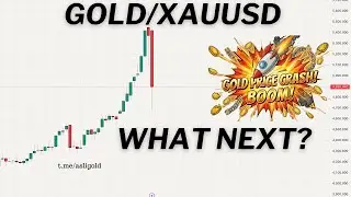 😳❗Gold/ XAUUSD Price Prediction Next Week February 2026 (Price Analysis) #gold #xauusd #trading