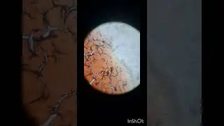 Blood under microscope.