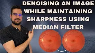 How to denoise an image using a median filter while keeping it still sharp?