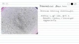 Hyaline Cartilage Connective Tissue