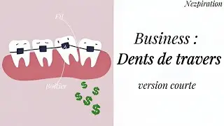 ❌ Aligner ses dents tout seul, est-ce possible ?