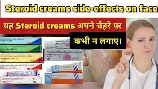 steroid creams side effects on face #steroids #incrediblehealthhindi