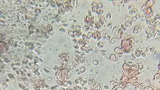 Real , red blood cells under microscope 😍😍, amazing