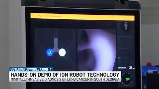 &lsquo;This changes things big time&rsquo;: SGMC robot improves lung cancer detection and accuracy
