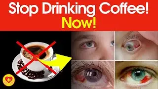 Stop Drinking Coffee Immediately If You Have These 10 Health Problems &ndash; Must Watch! ☕⚠️