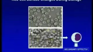 Storage Lesions in Cellular Blood Components