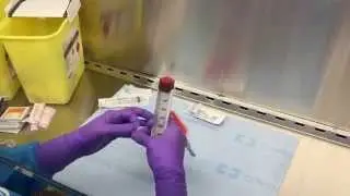 Embozene Tandem Microspheres in 100mg of Doxorubicin Loading Step 2